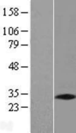 Novus Biologicals&trade;&nbsp;PNO1 Overexpression Lysate