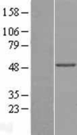 Novus Biologicals™ PNPLA1 Overexpression Lysate