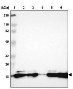 PNPLA4 Antibody, Novus Biologicals 0.1 mL | Buy Online | Novus Biologicals | Fisher Scientific