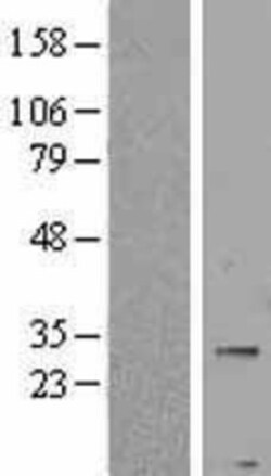 Novus Biologicals™ PNPLA4 Overexpression Lysate