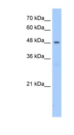 PNPLA5 Antibody, Novus Biologicals 20&mu;L; Unlabeled:Antibodies, Polyclonal