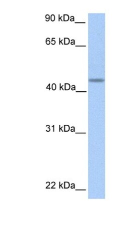 PNPLA5 Antibody, Novus Biologicals 100μL; Unlabeled:Antibodies, Polyclonal