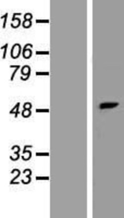 Novus Biologicals&trade;&nbsp;PNPLA5 Overexpression Lysate