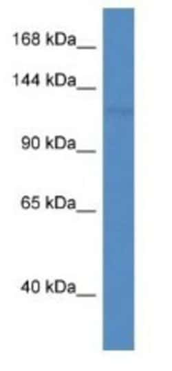 PNPLA6 Antibody, Novus Biologicals:Antibodies:Primary Antibodies