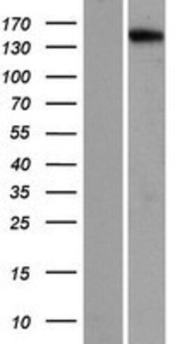Novus Biologicals&trade;&nbsp;PNPLA6 Overexpression Lysate