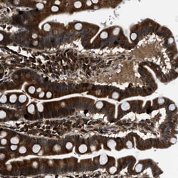 PNPLA8 Antibody, Novus Biologicals:Antibodies:Primary Antibodies