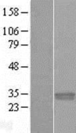 Novus Biologicals™ PNPO Overexpression Lysate