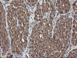 PNPO Antibody (OTI1G9), Novus Biologicals 0.1 mL | Buy Online | Novus Biologicals | Fisher Scientific