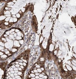 PNPT1 Antibody, Novus Biologicals 0.1mL; Unlabeled:Antibodies, Polyclonal