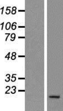 Novus Biologicals&trade;&nbsp;PNRC2 Overexpression Lysate
