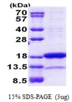 Novus Biologicals Recombinant Human PNRC2 His Protein 0.1 mg | Buy Online | Novus Biologicals&trade; | Fisher Scientific