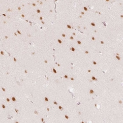 PNUTS/PPP1R10 Antibody, Novus Biologicals:Antibodies:Primary Antibodies