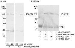 PNUTS/PPP1R10 Antibody, Novus Biologicals 0.1mL; Unlabeled:Antibodies,