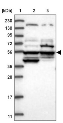 PCCB Antibody, Novus Biologicals:Antibodies:Primary Antibodies