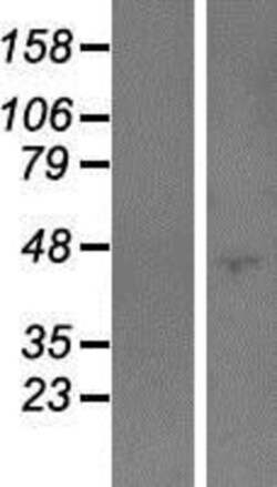 Novus Biologicals&trade;&nbsp;PODNL1 Overexpression Lysate