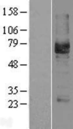 Novus Biologicals&trade;&nbsp;Podocalyxin Like Overexpression Lysate