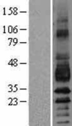 Novus Biologicals&trade;&nbsp;Podoplanin Overexpression Lysate