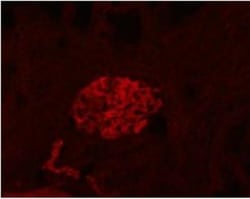 Podoplanin Antibody (LF3/B7/D5B27) - Azide and BSA Free, Novus Biologicals:Antibodies:Primary