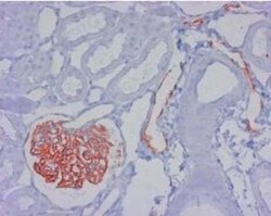 Podoplanin Antibody (LF3/B7/D5B27) - Azide and BSA Free, Novus Biologicals:Antibodies:Primary