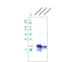 Podoplanin Antibody (RTD4E10) - Azide and BSA Free, Novus Biologicals 0.1 mg | Buy Online | Novus Biologicals | Fisher Scientific