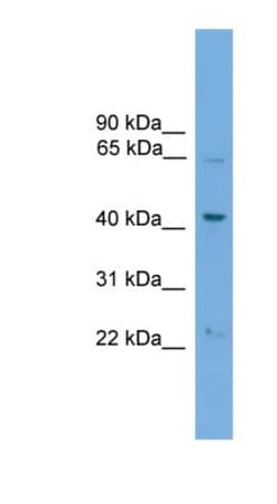 Endoglycan/PODXL2 Antibody, Novus Biologicals 100 &mu;L | Buy Online | Novus Biologicals | Fisher Scientific