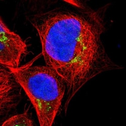 POF1B Antibody, Novus Biologicals 25 &mu;L | Buy Online | Novus Biologicals | Fisher Scientific