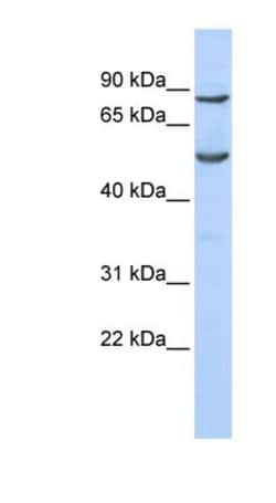 POGK Antibody, Novus Biologicals 100&mu;L; Unlabeled:Antibodies, Polyclonal