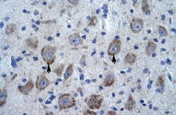 POLDIP1 Antibody, Novus Biologicals 0.05mg; Unlabeled:Antibodies, Polyclonal