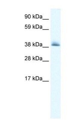 POLDIP1 Antibody, Novus Biologicals 0.05mg; Unlabeled:Antibodies, Polyclonal