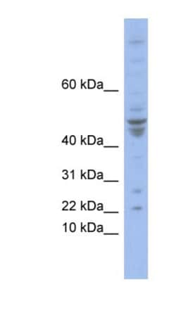 POLE4 Antibody, Novus Biologicals 100 &mu;L | Buy Online | Novus Biologicals | Fisher Scientific