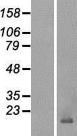 Novus Biologicals™ POLE4 Overexpression Lysate