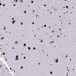 POLR1A Antibody, Novus Biologicals:Antibodies:Primary Antibodies