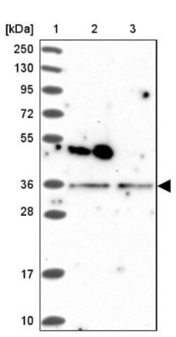 POLR2C Antibody, Novus Biologicals 0.1mL; Unlabeled:Antibodies, Polyclonal