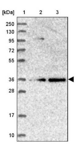 POLR2C Antibody, Novus Biologicals 0.1mL; Unlabeled:Antibodies, Polyclonal
