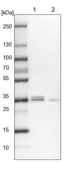 POLR2C Antibody, Novus Biologicals 0.1mL; Unlabeled:Antibodies, Polyclonal