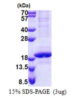 Novus Biologicals&trade;&nbsp;Recombinant Human POLR2D His Protein