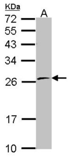 POLR2E Antibody, Novus Biologicals 0.1mL; Unlabeled:Antibodies, Polyclonal