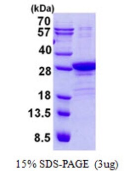 Novus Biologicals&trade;&nbsp;Recombinant Human POLR2E His Protein