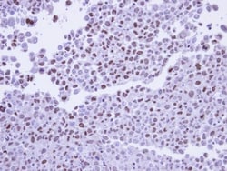 POLR2G Antibody, Novus Biologicals 0.1mg; Unlabeled:Antibodies, Polyclonal