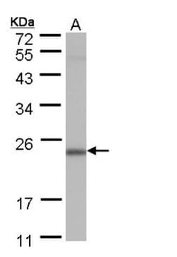 POLR2G Antibody, Novus Biologicals 0.1mg; Unlabeled:Antibodies, Polyclonal