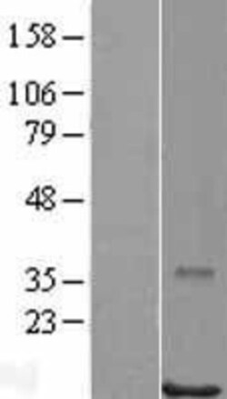 Novus Biologicals&trade;&nbsp;POLR2J Overexpression Lysate