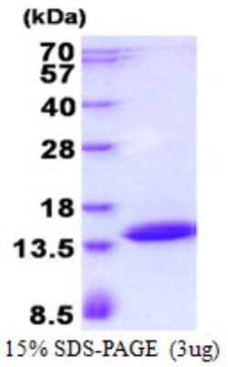 Novus Biologicals&trade;&nbsp;Recombinant Human POLR2J3 His Protein