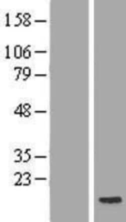 Novus Biologicals™ POLR2J2 Overexpression Lysate