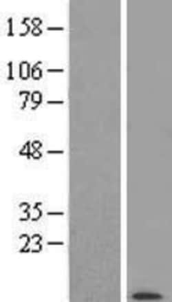 Novus Biologicals&trade;&nbsp;POLR2K Overexpression Lysate
