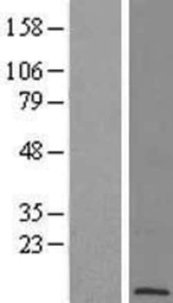 Novus Biologicals&trade;&nbsp;POLR2L Overexpression Lysate