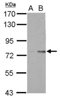 POLR3E Antibody, Novus Biologicals 0.1mL; Unlabeled:Antibodies, Polyclonal