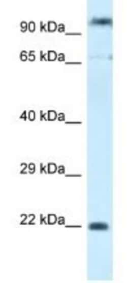 POLR3GL Antibody, Novus Biologicals 100&mu;L; Unlabeled:Antibodies, Polyclonal