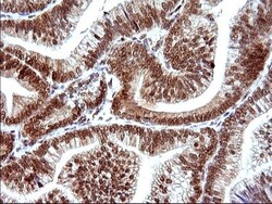 POLR3GL Antibody (OTI5E8), Novus Biologicals 0.1 mL | Buy Online | Novus Biologicals | Fisher Scientific