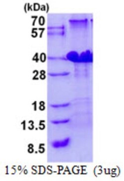 Novus Biologicals&trade;&nbsp;Recombinant Human POLR3H His Protein
