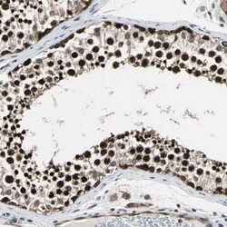 POLR3K Antibody, Novus Biologicals 0.1mL; Unlabeled:Antibodies, Polyclonal